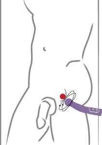 Prostate Twister zum Prostata melken